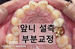 수술전