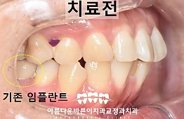 수술전