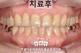 수술후