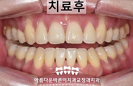 수술후