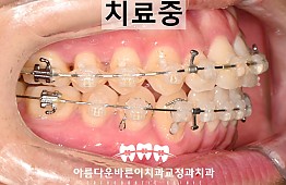 수술후