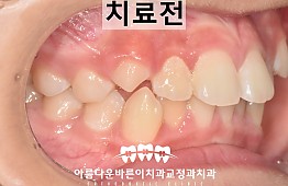 수술전