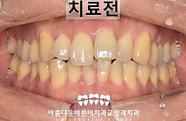 수술전