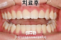 수술후