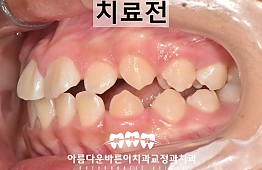 수술전
