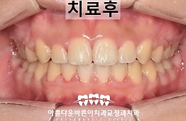 수술후
