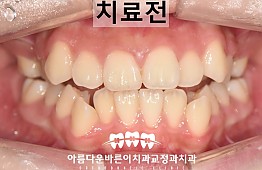 수술전