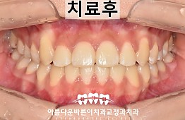 수술후