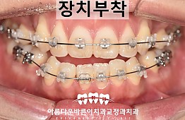 수술후