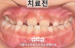수술전