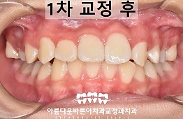 수술후