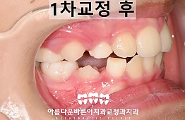 수술후