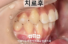 수술후