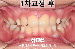 수술후