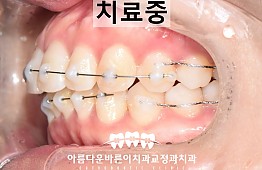 수술후