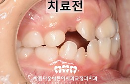 수술전