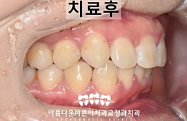 수술후