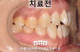 수술전