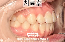 수술후