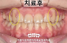 수술후