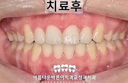수술후
