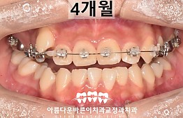 수술후