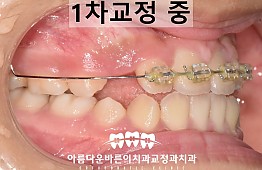 수술후