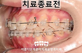 수술후