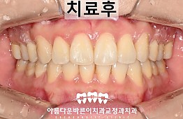수술후