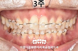 수술후