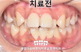 수술전