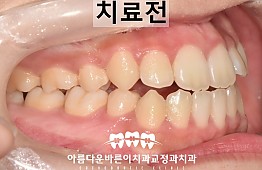 수술전