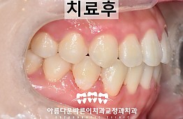 수술후