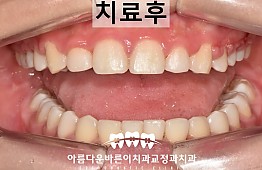 수술후