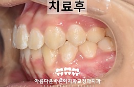 수술후