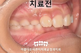 수술전