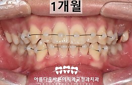 수술후