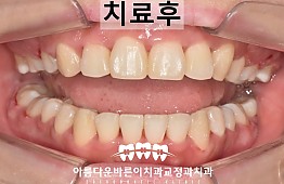 수술후