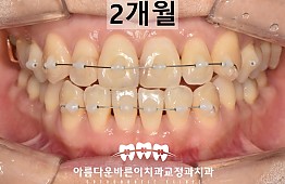 수술후