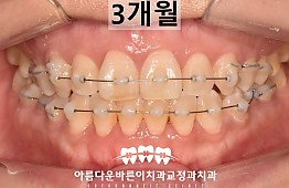 수술후