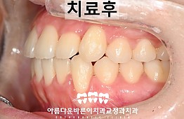 수술후