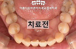 수술전