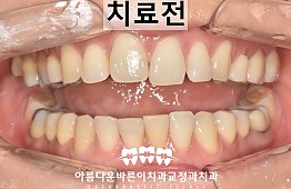 수술전