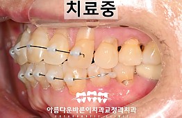 수술후