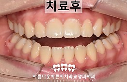 수술후