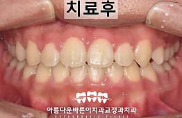 수술후