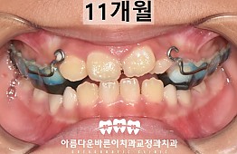 수술후