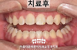 수술후