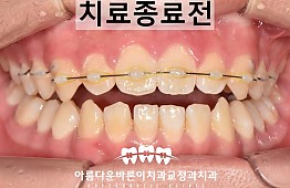 수술후
