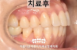 수술후